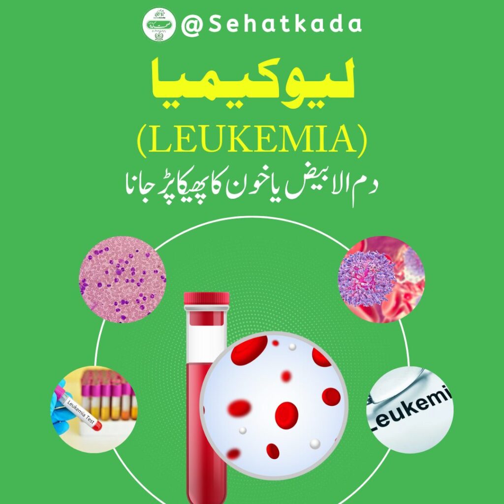 لیوکیمیا علاج, دم الابیض کا علاج, Leukemia Herbal Treatment, دم الابیض نسخہ, Leukemia Desi Ilaj, Blood Disorder Herbal Remedy, Ilaj bil Ghiza, Qanoon Mufrad Aza, Tib e Unani, Ayurvedic Medicine, Herbal Remedies, Sehatkada, Sahatkada, Hakeem Muzamil Rafiquei, Hakeem Muhammad Rafique, Hakeem Sabir Multani, Hakeem Yaseen