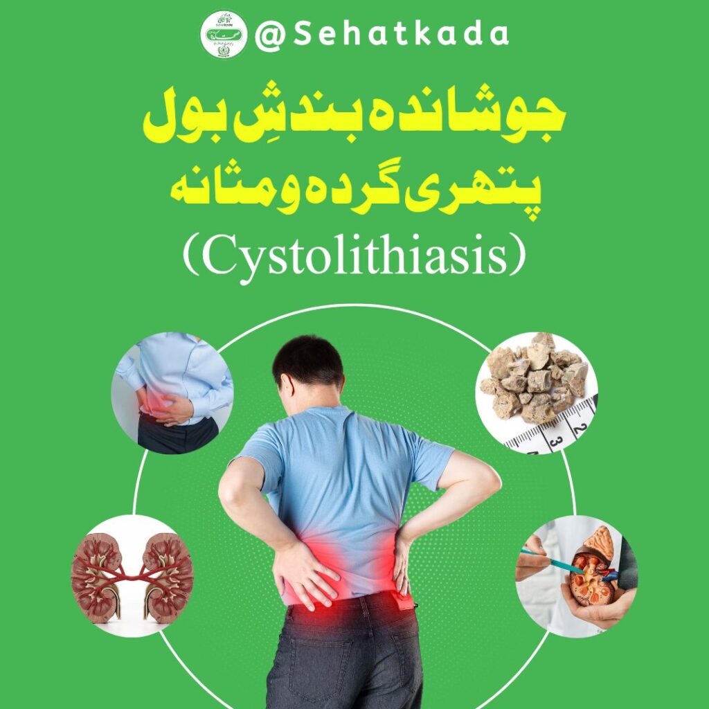 • جوشاندہ برائے بندش بول • گردہ و مثانہ کی پتھری کا علاج • Pathri ka Desi Ilaj • Joshanda for Urinary Retention • Herbal Treatment for Kidney Stones • Herbal Medicine for Cystolithiasis • علاج بالغذا (Ilaj bil Ghiza) • قانون مفرد اعضاء (Qanoon Mufrad Aza) • طب یونانی (Tib e Unani) • Ayurvedic Medicine • Herbal Remedies • Sehatkada, Sahatkada • Hakeem Muzamil Rafiquei • Hakeem Muhammad Rafique • Hakeem Sabir Multani • Hakeem Yaseen جوشاندہ, بندش بول کا علاج, پتھری گردہ مثانہ علاج, Cystolithiasis treatment, Kidney stone herbal remedy, Urinary retention cure, Sehatkada Herbal, Tib e Unani, Ayurvedic, Ilaj bil Ghiza