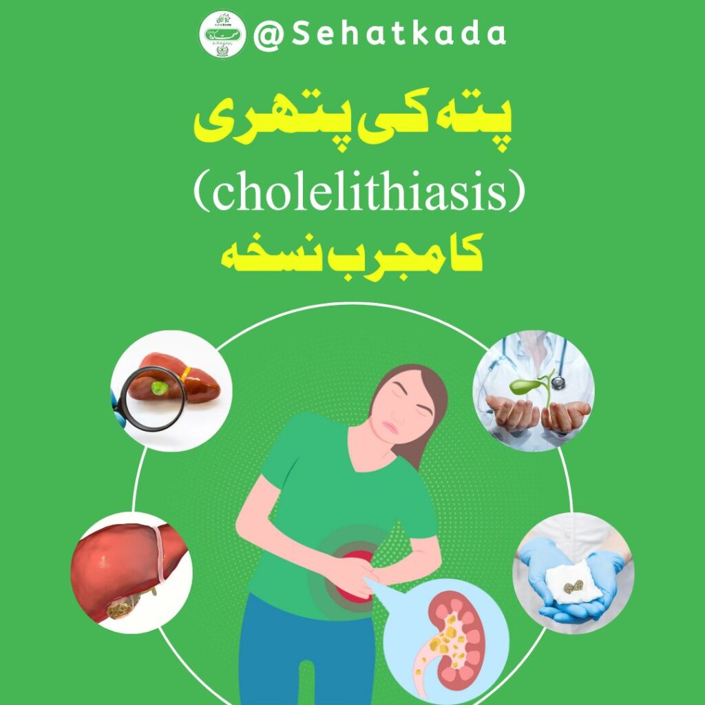 پتہ کی پتھری کا علاج | Gallstones Herbal Remedy | Cholelithiasis Treatment | Pitta ki Pathri ka Ilaj