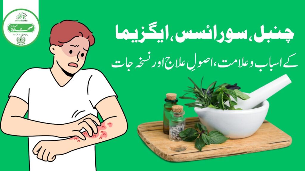 Psoriasis (Chambal / Eczema) Treatment – Asbab, Alamat & Desi Nuskhe in Tib e Unani